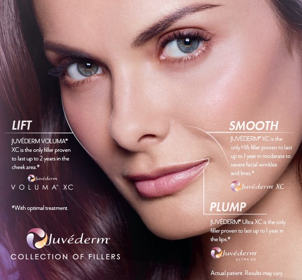 Juvederm-Special lift